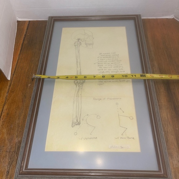 Framed Anatomy Art Spine Replaced With Arm Bone 21” x 13” Interesting Piece - Picture 8 of 9